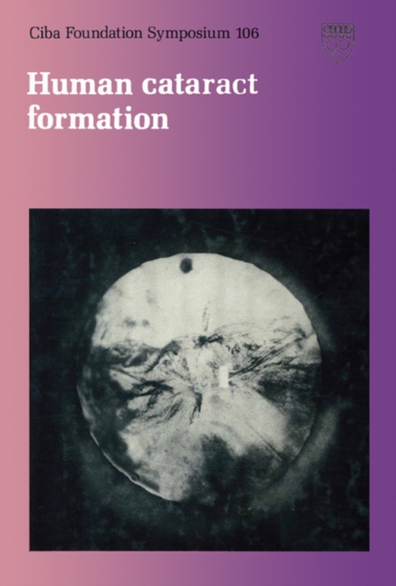 Human Cataract Formation (e-bog) af -