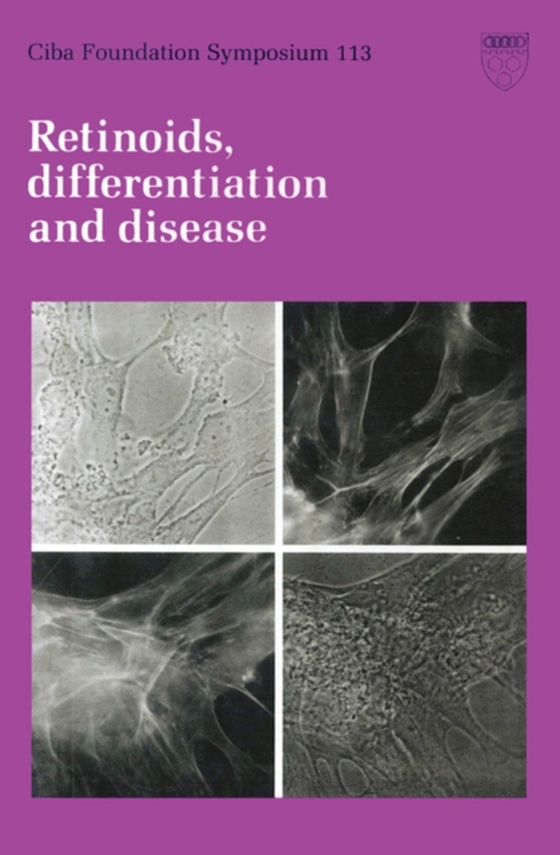 Retinoids, Differentiation and Disease (e-bog) af -