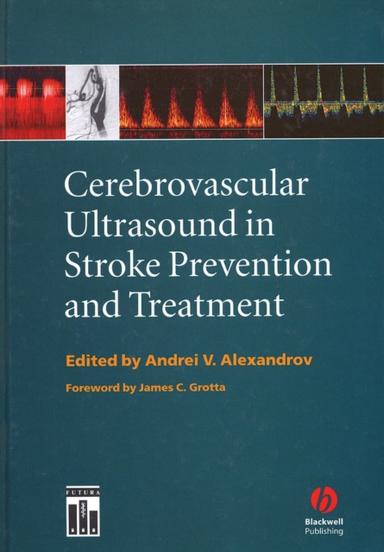 Cerebrovascular Ultrasound in Stroke Prevention and Treatment (e-bog) af -