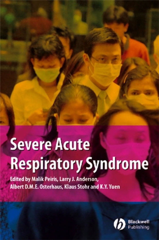 Severe Acute Respiratory Syndrome (e-bog) af -