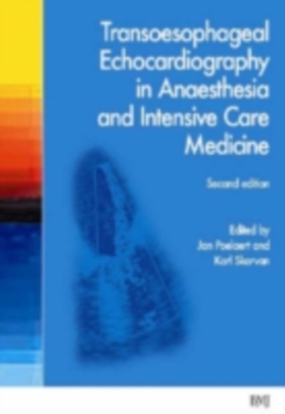 Transoesophageal Echocardiography in Anaesthesia and Intensive Care Medicine (e-bog) af -