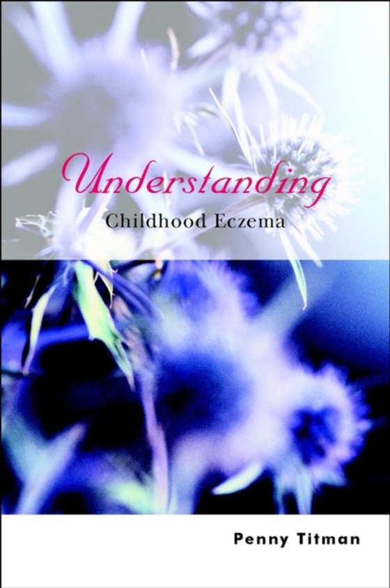 Understanding Childhood Eczema (e-bog) af Titman, Penny