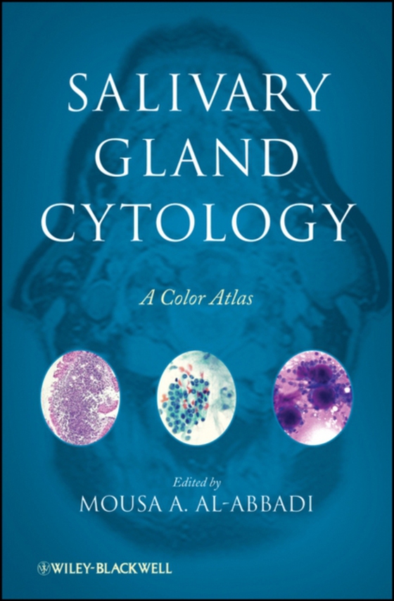 Salivary Gland Cytology (e-bog) af -