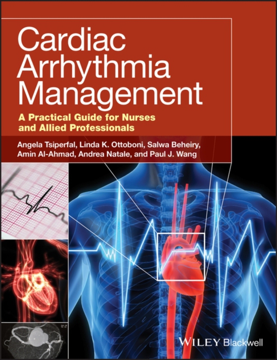 Cardiac Arrhythmia Management (e-bog) af -