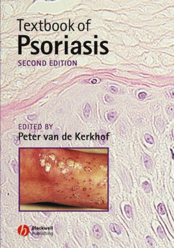 Textbook of Psoriasis (e-bog) af -