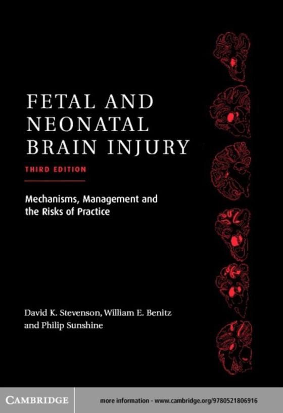 Fetal and Neonatal Brain Injury (e-bog) af -