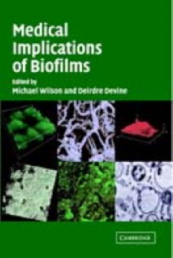 Medical Implications of Biofilms (e-bog) af -