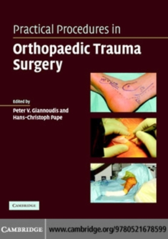 Practical Procedures in Orthopaedic Trauma Surgery (e-bog) af Pape, Hans-Christian