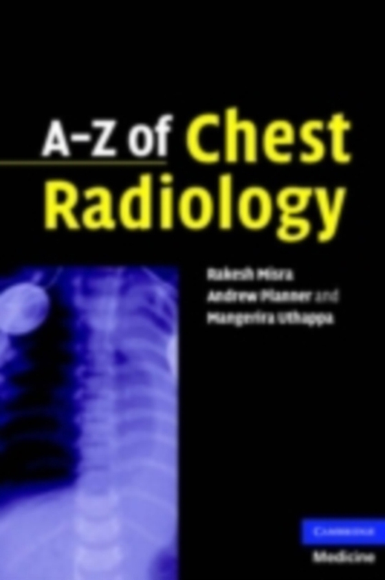 A-Z of Chest Radiology (e-bog) af Misra, Rakesh