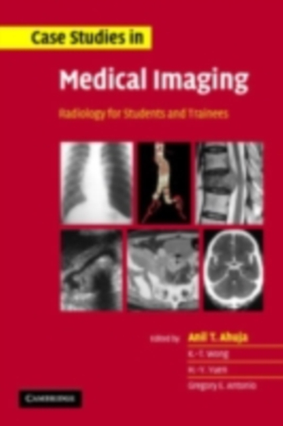 Case Studies in Medical Imaging (e-bog) af -