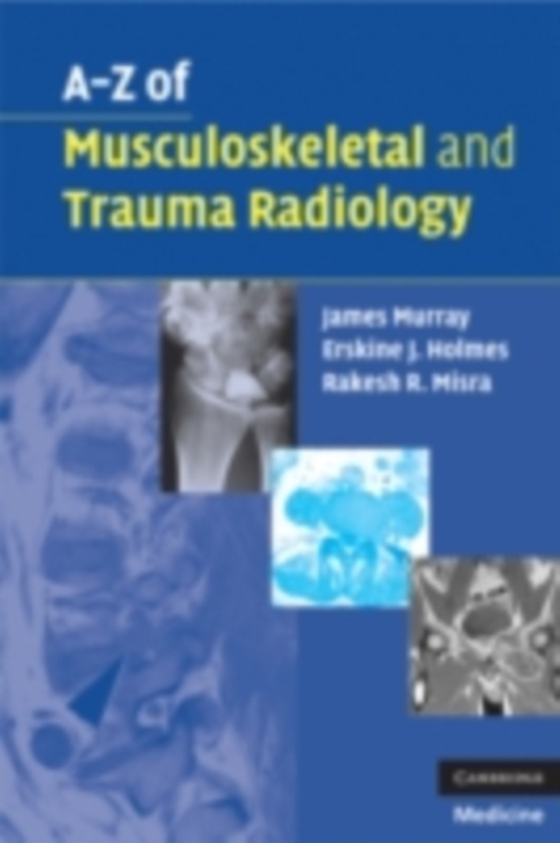 A-Z of Musculoskeletal and Trauma Radiology (e-bog) af Misra, Rakesh R.