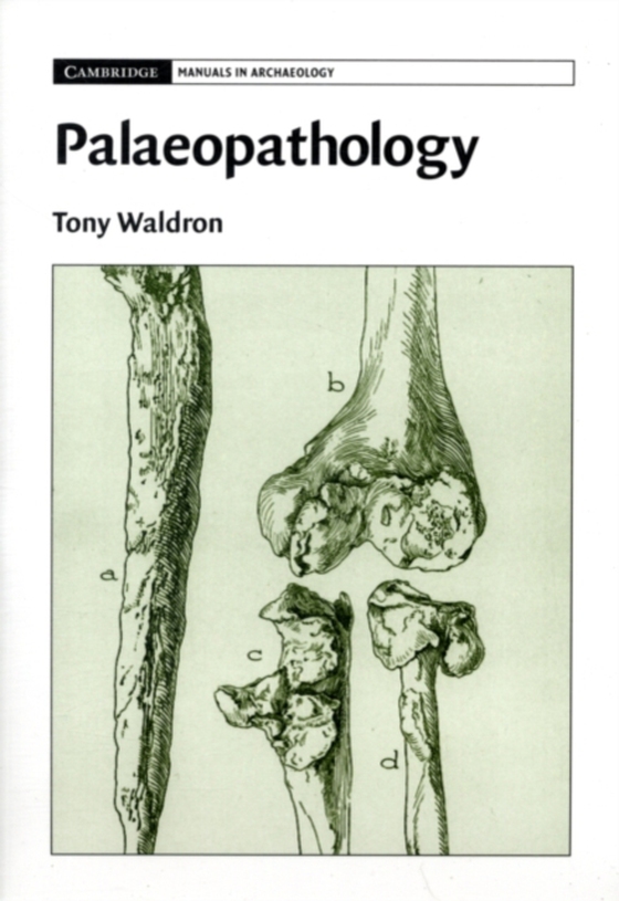 Palaeopathology