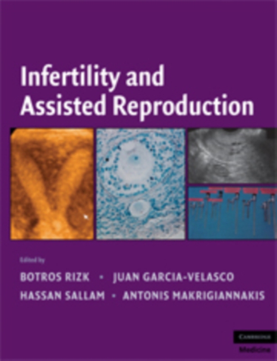 Infertility and Assisted Reproduction (e-bog) af -