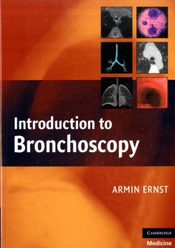 Introduction to Bronchoscopy (e-bog) af -