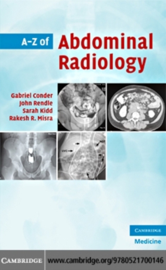 A-Z of Abdominal Radiology (e-bog) af Misra, Rakesh R.