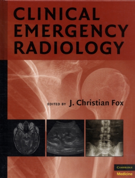 Clinical Emergency Radiology (e-bog) af -