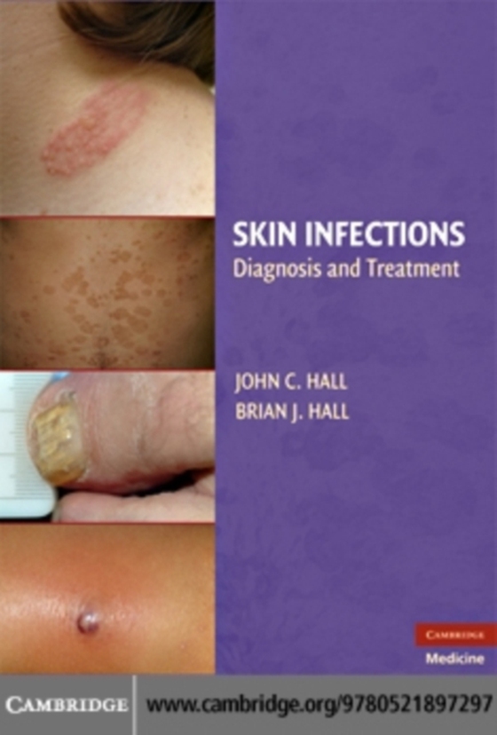 Skin Infections (e-bog) af Hall, Brian J.