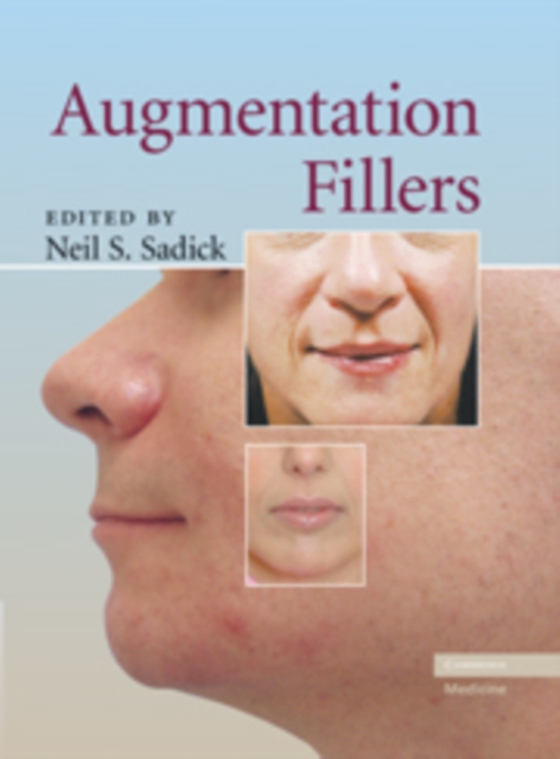 Augmentation Fillers (e-bog) af -