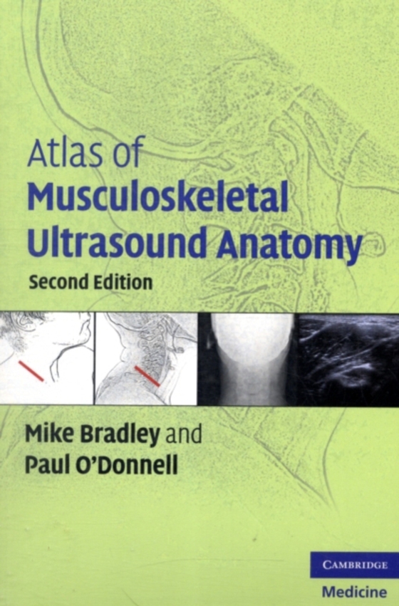 Atlas of Musculoskeletal Ultrasound Anatomy (e-bog) af O'Donnell, Paul