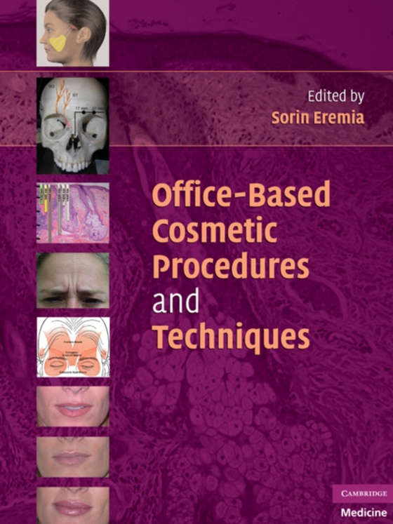 Office-Based Cosmetic Procedures and Techniques (e-bog) af -