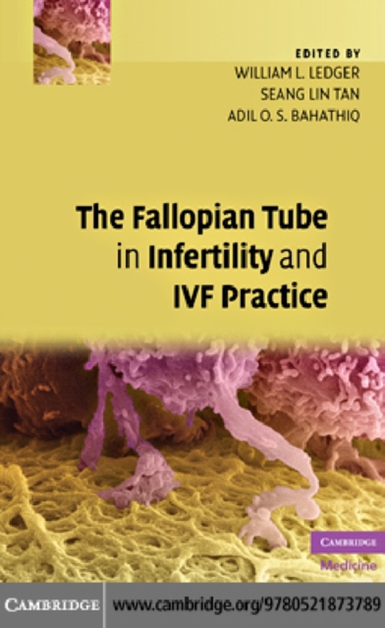 Fallopian Tube in Infertility and IVF Practice