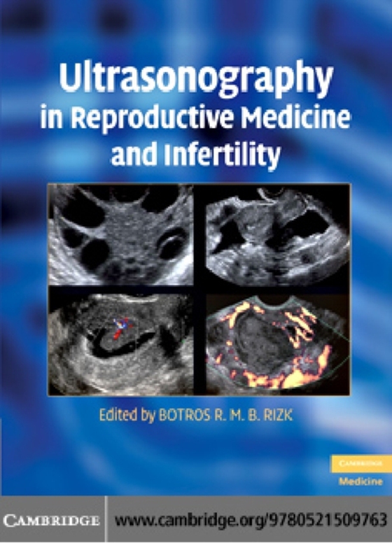 Ultrasonography in Reproductive Medicine and Infertility (e-bog) af -