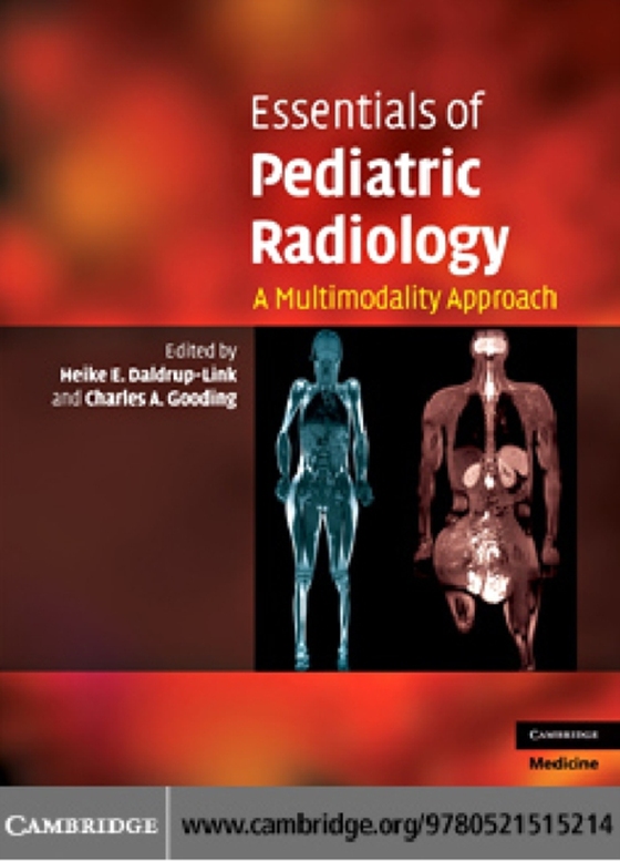 Essentials of Pediatric Radiology (e-bog) af -