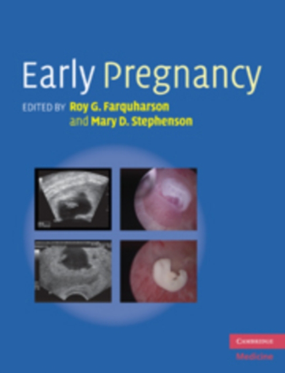 Early Pregnancy (e-bog) af -