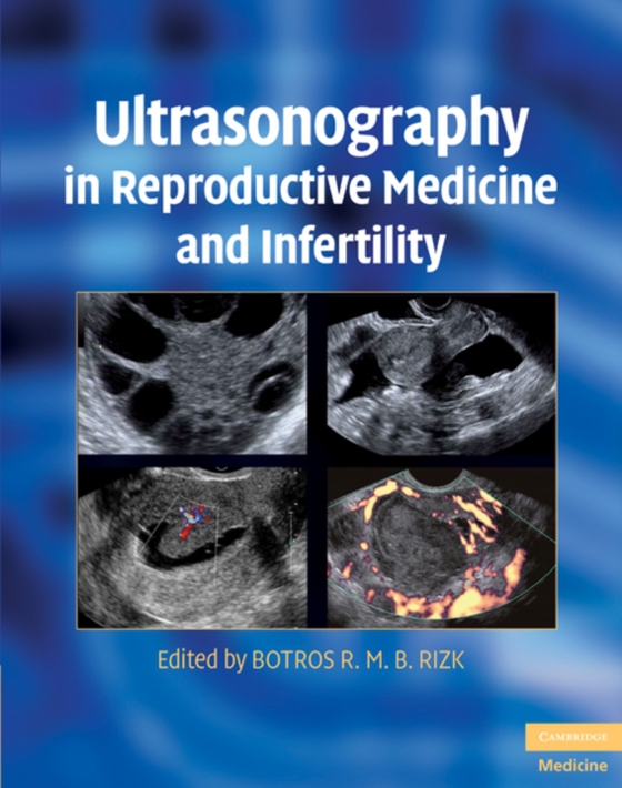 Ultrasonography in Reproductive Medicine and Infertility (e-bog) af -