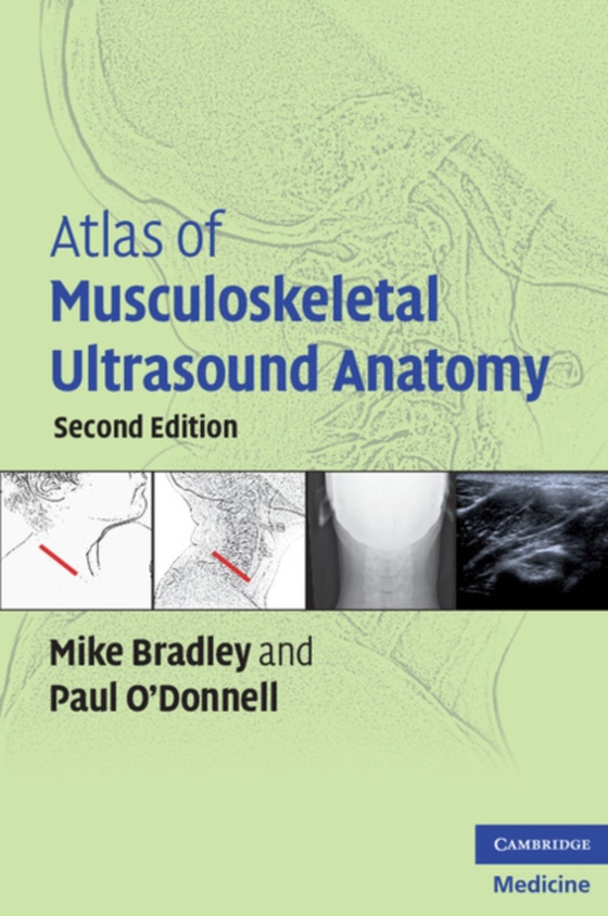 Atlas of Musculoskeletal Ultrasound Anatomy (e-bog) af O'Donnell, Paul