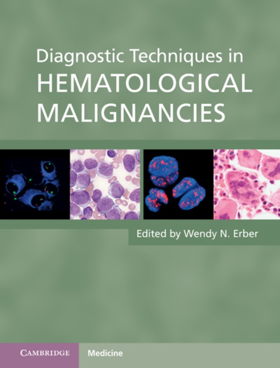 Diagnostic Techniques in Hematological Malignancies (e-bog) af -