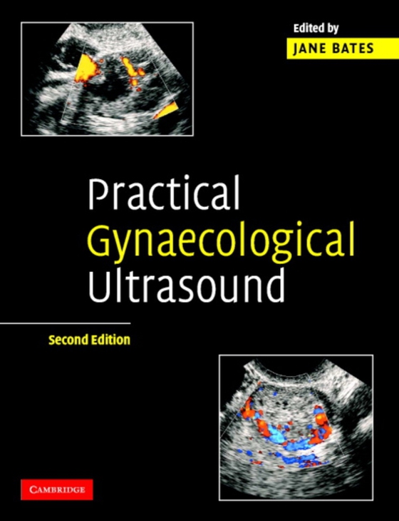 Practical Gynaecological Ultrasound