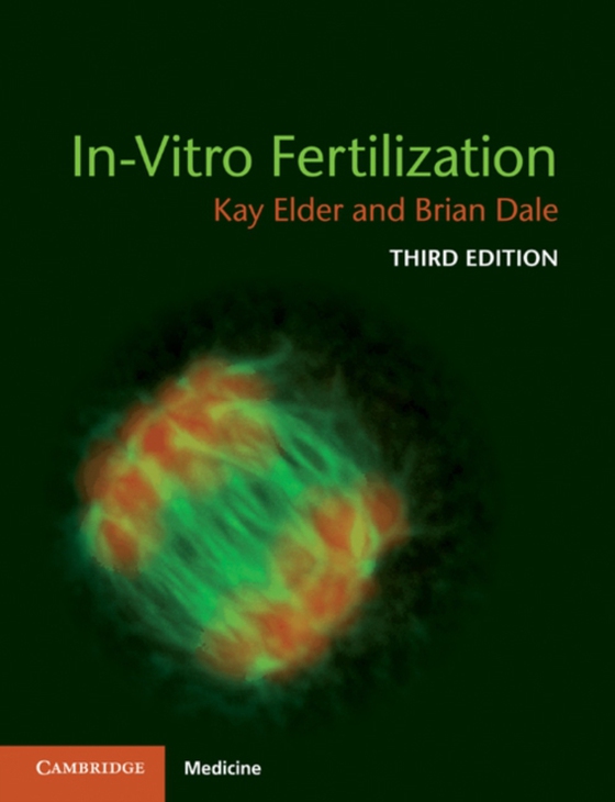 In-Vitro Fertilization (e-bog) af Dale, Brian