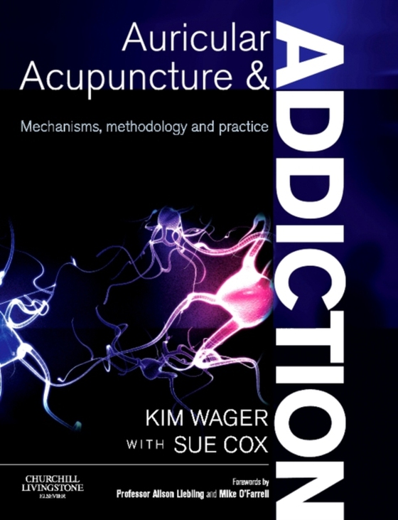 Auricular Acupuncture and Addiction E-Book (e-bog) af Cox, Sue