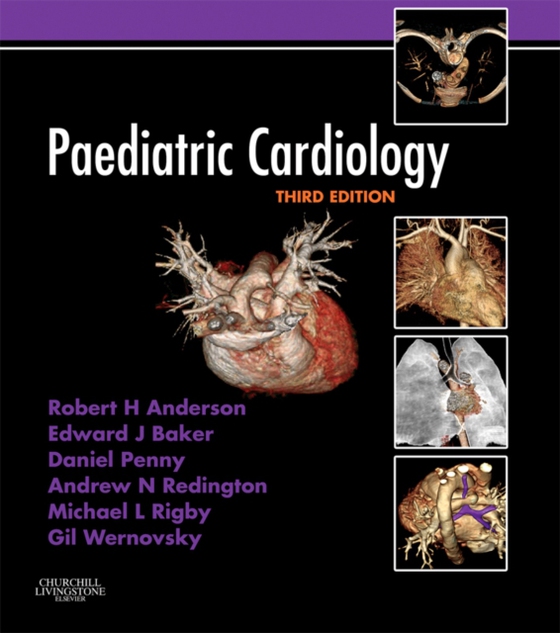 Paediatric Cardiology (e-bog) af Wernovsky, Gil