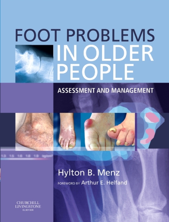 Foot Problems in Older People E-Book (e-bog) af Menz, Hylton B.