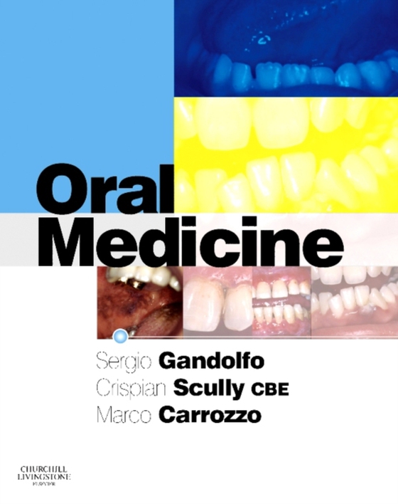 Oral Medicine E-Book (e-bog) af Carrozzo, Marco
