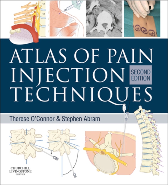 Atlas of Pain Injection Techniques E-Book (e-bog) af Abram, Stephen E.