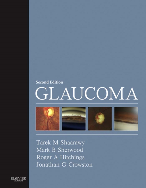 Glaucoma E-Book