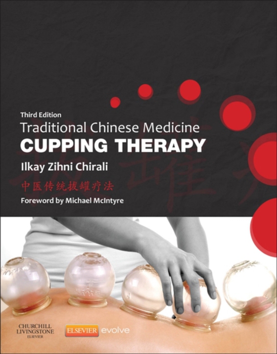 Traditional Chinese Medicine Cupping Therapy - E-Book (e-bog) af Chirali, Ilkay Z.