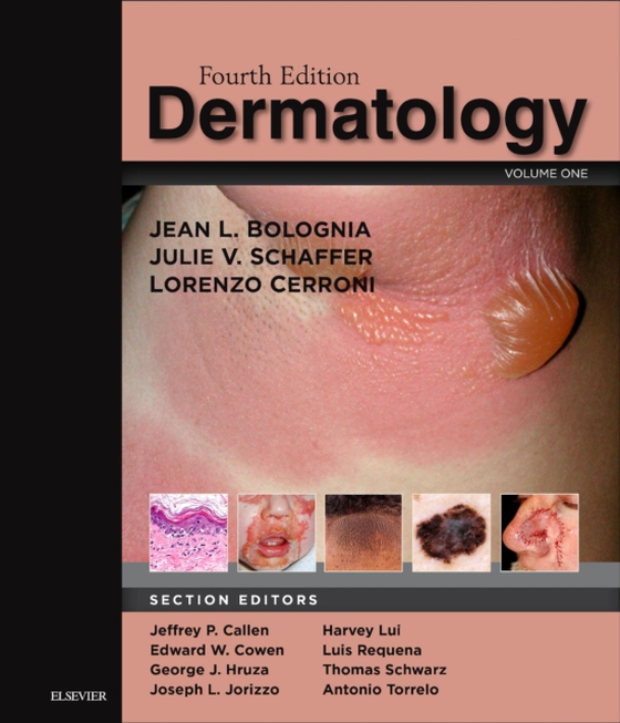 Dermatology E-Book