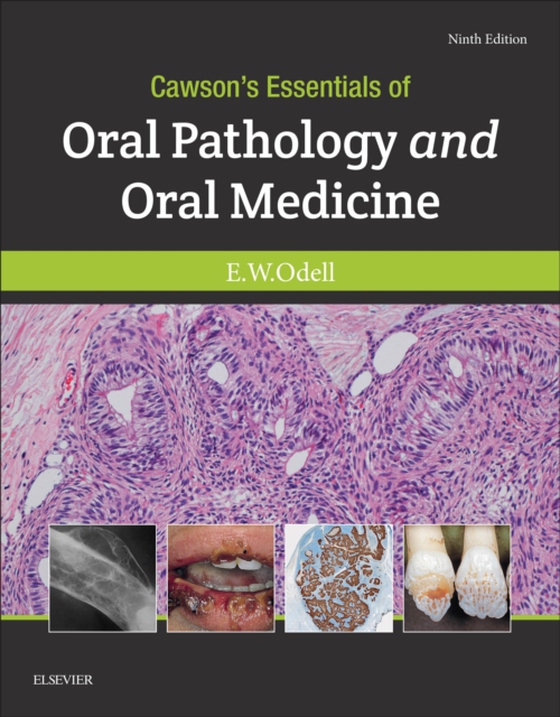 Cawson's Essentials of Oral Pathology and Oral Medicine E-Book (e-bog) af Odell, Edward W