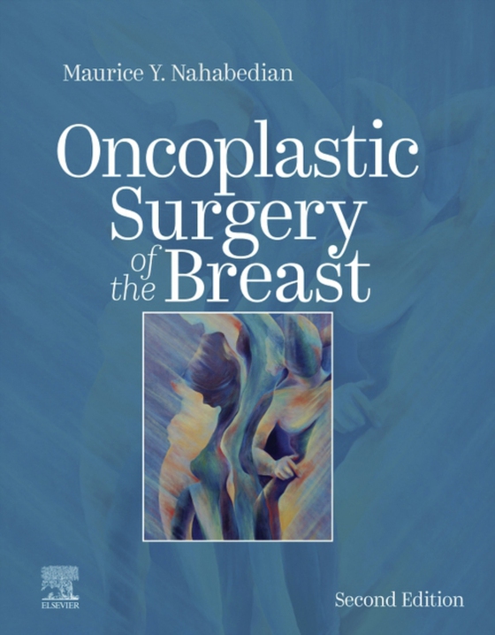 Oncoplastic Surgery of the Breast E-Book (e-bog) af Nahabedian, Maurice Y