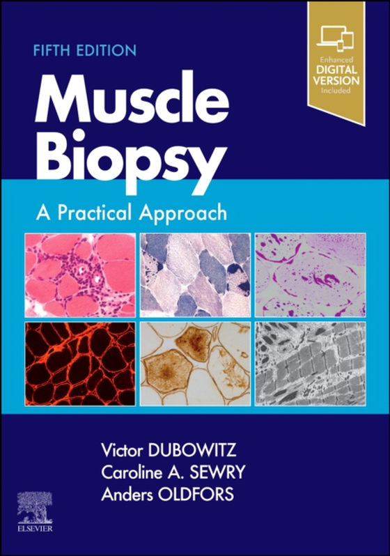 Muscle Biopsy E-Book (e-bog) af Oldfors, Anders