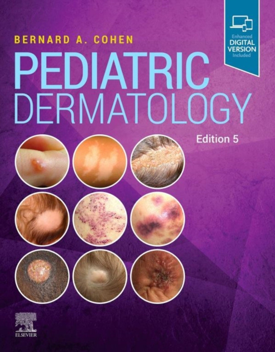 Pediatric Dermatology E-Book (e-bog) af Cohen, Bernard A