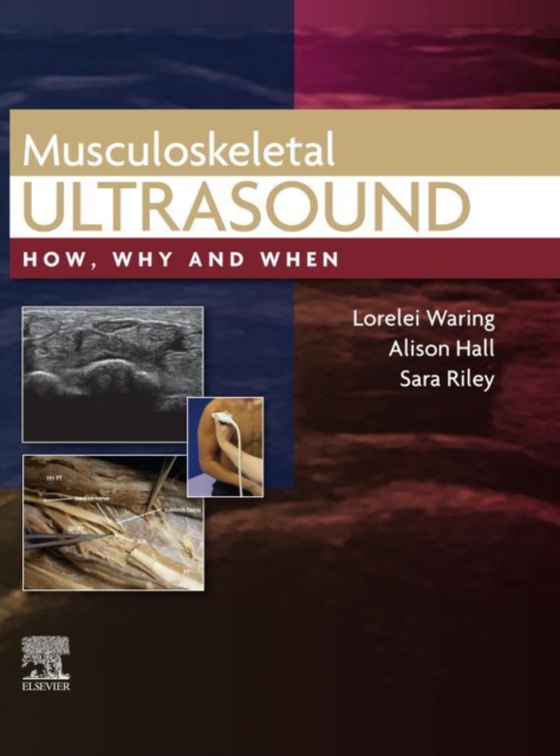 Musculoskeletal Ultrasound, E-Book (e-bog) af Riley, Sara