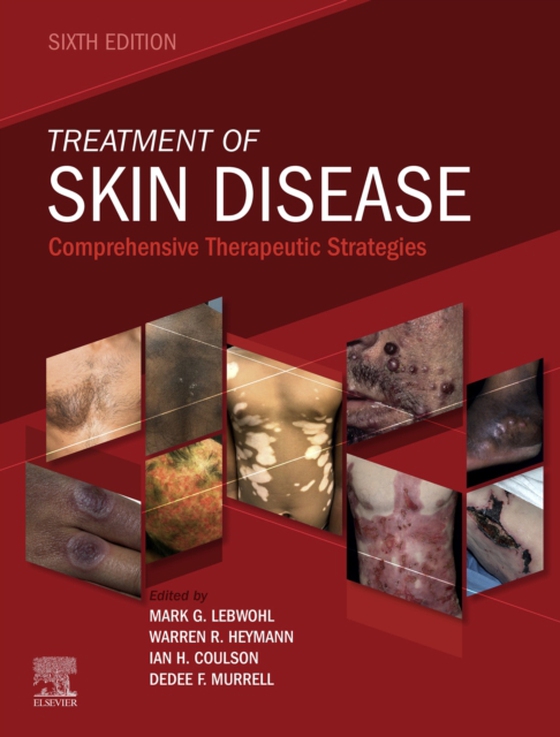 Treatment of Skin Disease E-Book (e-bog) af Murrell, Dedee