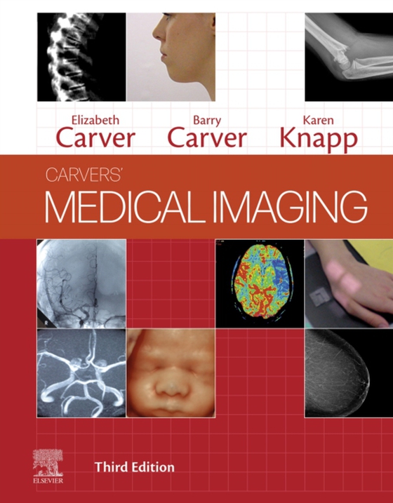 Medical Imaging - E-Book (e-bog) af Knapp, Karen