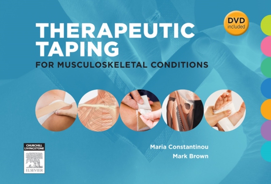 Therapeutic Taping for Musculoskeletal Conditions - E-Book (e-bog) af Brown, Mark