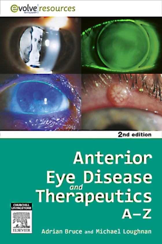 Anterior Eye Disease and Therapeutics A-Z - E-Book (e-bog) af Loughnan, Michael Stephen